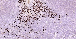 Invitrogen&trade;&nbsp;Human IgG2 Recombinant Rabbit Monoclonal Antibody (1E7)