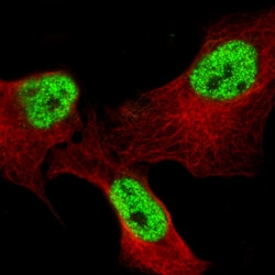 Invitrogen&trade;&nbsp;BCL6 Monoclonal Antibody (CL14612)