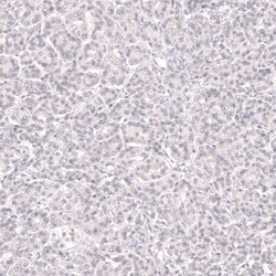 Invitrogen BCL6 Monoclonal Antibody (CL14612) 100 &mu;L | Buy Online | Invitrogen&trade; | Fisher Scientific