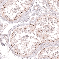 Invitrogen BCL6 Monoclonal Antibody (CL14612) 100 &mu;L | Buy Online | Invitrogen&trade; | Fisher Scientific