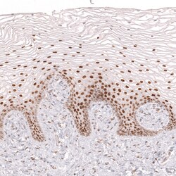 Invitrogen BCL6 Monoclonal Antibody (CL14612) 100 &mu;L | Buy Online | Invitrogen&trade; | Fisher Scientific