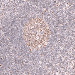 Invitrogen BCL6 Monoclonal Antibody (CL14612) 100 &mu;L | Buy Online | Invitrogen&trade; | Fisher Scientific