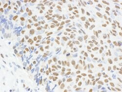 MAD2 Rabbit anti-Human, Polyclonal, Bethyl Laboratories 100 &mu;L; Unconjugated:Antibodies,