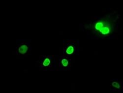 MAD2L1 Mouse anti-Human, Clone: OTI4D2, liquid, TrueMAB 100 &mu;L; Unconjugated:Antibodies,