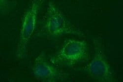 MADCAM1 Monoclonal Antibody (OTI1E1), TrueMAB , OriGene:Antibodies:Primary