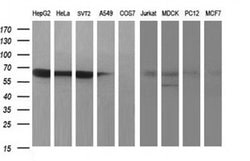 MADCAM1 Monoclonal Antibody (OTI1B7), TrueMAB , OriGene:Antibodies:Primary