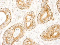 MADD Polyclonal Antibody, Bethyl Laboratories 10 &mu;L; Unconjugated:Antibodies,