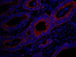 MADD Polyclonal Antibody, Bethyl Laboratories 10 &mu;L; Unconjugated:Antibodies,