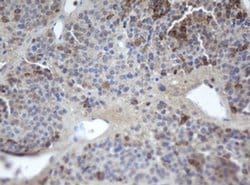 MAFB Monoclonal Antibody (OTI1F1), TrueMAB , OriGene:Antibodies:Primary