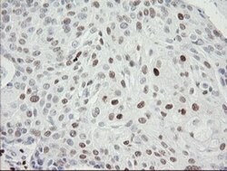 MAFB Monoclonal Antibody (OTI1E9), TrueMAB , OriGene:Antibodies:Primary