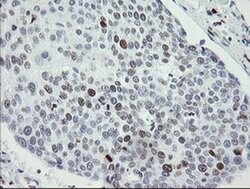 MAFB Monoclonal Antibody (OTI1E9), TrueMAB , OriGene 100 &mu;L; Unconjugated:Antibodies,