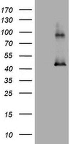 MAGEA3 Mouse anti-Human, Clone: OTI2B1, TrueMAB , Origene 30 &mu;L; Unconjugated:Antibodies,