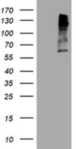 MAGEA3 Mouse anti-Human, Clone: OTI2E11, lyophilized, TrueMAB 100 &mu;g;
