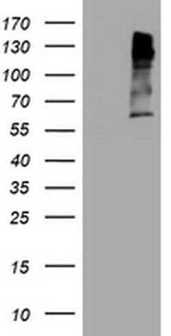 MAGEA3 Monoclonal Antibody (OTI2E11), TrueMAB , OriGene:Antibodies:Primary