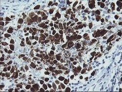 MAGEA4 Mouse anti-Human, Clone: OTI1F9, lyophilized, TrueMAB 100 &mu;g;