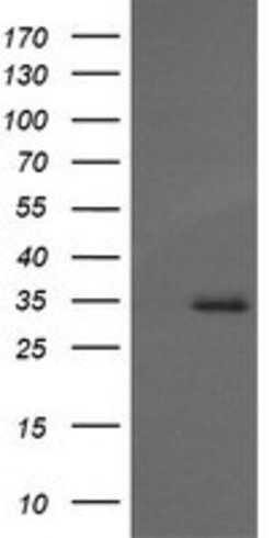 MAGEA4 Mouse anti-Human, Clone: OTI1F9, lyophilized, TrueMAB 100 &mu;g;