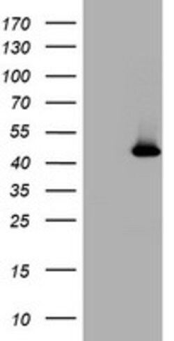 MAGEA4 Mouse anti-Human, Clone: OTI5E8, lyophilized, TrueMAB 100 &mu;g;