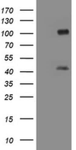 MAGEA9 Monoclonal Antibody (OTI1C6), TrueMAB , OriGene 30 &mu;L | Buy Online | Origene Technologies | Fisher Scientific