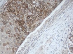 MAGEB1 Mouse anti-Canine, Human, Mouse, Clone: OTI4E12, lyophilized, TrueMAB