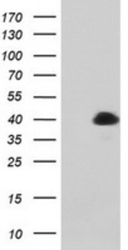 MAGEB1 Mouse anti-Canine, Human, Mouse, Clone: OTI4E12, lyophilized, TrueMAB