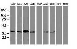 MAGEB1 Mouse anti-Canine, Human, Mouse, Clone: OTI4E12, lyophilized, TrueMAB