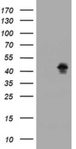 MAGEB1 Monoclonal Antibody (OTI3B7), TrueMAB , OriGene 100 &mu;L; Unconjugated:Antibodies,