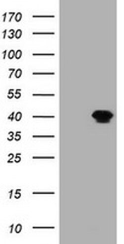 MAGEB1 Monoclonal Antibody (OTI7D9), TrueMAB , OriGene:Antibodies:Primary