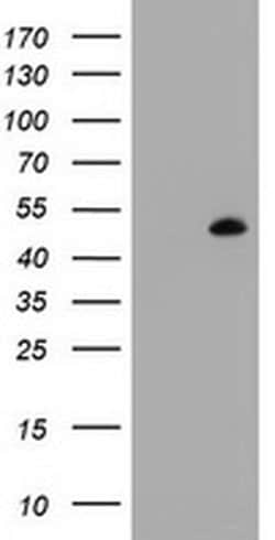 MAGEB1 Monoclonal Antibody (OTI5F7), TrueMAB , OriGene 100 &mu;L; Unconjugated:Antibodies,