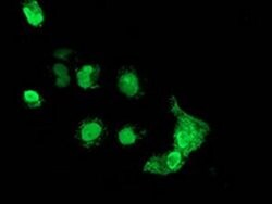MAGEB18 Monoclonal Antibody (OTI1F5), TrueMAB , OriGene 100 &mu;L; Unconjugated:Antibodies,