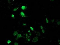 MAGEB18 Mouse anti-Human, Clone: OTI6A5, lyophilized, TrueMAB 100 &mu;g;