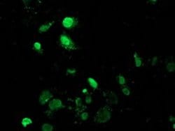 MAGEB18 Monoclonal Antibody (OTI6A5), TrueMAB , OriGene:Antibodies:Primary