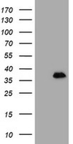 MAGEB18 Monoclonal Antibody (OTI1F5), TrueMAB , OriGene 100 &mu;L; Unconjugated:Antibodies,