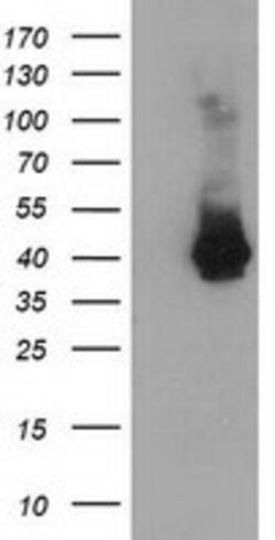 MAGEB18 Mouse anti-Human, Clone: OTI6A5, lyophilized, TrueMAB 100 &mu;g;