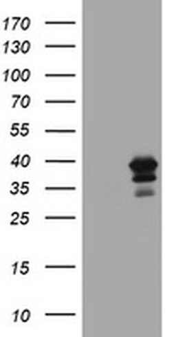 MAGEB18 Monoclonal Antibody (OTI1H2), TrueMAB , OriGene 30 &mu;L | Buy Online | Origene Technologies | Fisher Scientific