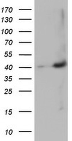 MAGEB18 Monoclonal Antibody (OTI9F9), TrueMAB , OriGene 30 &mu;L; Unconjugated:Antibodies,
