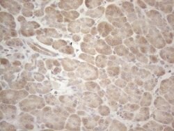 MAGEB3 Mouse anti-Human, Clone: OTI5H8, lyophilized, TrueMAB 100 &mu;g;