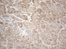 MAGEB3 Monoclonal Antibody (OTI5H8), TrueMAB , OriGene 100 &mu;L; Unconjugated:Antibodies,