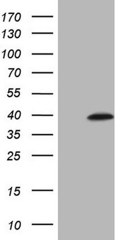 MAGEB3 Monoclonal Antibody (OTI1D3), TrueMAB , OriGene 100 &mu;L; Unconjugated:Antibodies,
