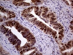 MAGEB4 Monoclonal Antibody (OTI1B5), TrueMAB , OriGene 100 &mu;L; Unconjugated:Antibodies,