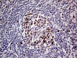 MAGEB4 Monoclonal Antibody (OTI1B5), TrueMAB , OriGene 100 &mu;L; Unconjugated:Antibodies,