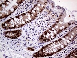 MAGEB4 Monoclonal Antibody (OTI1B5), TrueMAB , OriGene 100 &mu;L; Unconjugated:Antibodies,