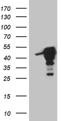 MAGEB4 Monoclonal Antibody (OTI3A6), TrueMAB , OriGene 100 &mu;L; Unconjugated:Antibodies,