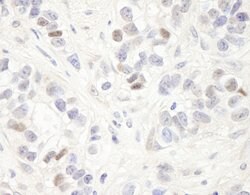 MAGED2 Rabbit anti-Human, Polyclonal, Bethyl Laboratories 100 &mu;l; Unlabeled:Antibodies,