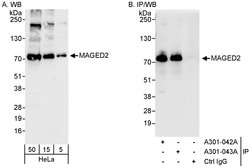 MAGED2 Rabbit anti-Human, Polyclonal, Bethyl Laboratories 100 &mu;l; Unlabeled:Antibodies,