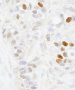 MAGED2 Polyclonal Antibody, Bethyl Laboratories 100 &mu;L; Unconjugated:Antibodies,