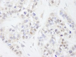 MAGED2 Polyclonal Antibody, Bethyl Laboratories 100 &mu;L; Unconjugated:Antibodies,
