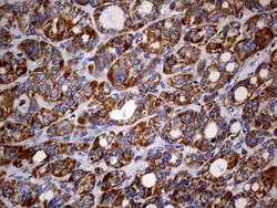 MAK Monoclonal Antibody (OTI1G2), TrueMAB , OriGene 30 &mu;L; Unconjugated:Antibodies,