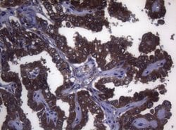 MAK Monoclonal Antibody (OTI5A7), TrueMAB , OriGene 100 &mu;L; Unconjugated:Antibodies,
