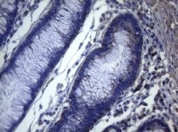 MAK Monoclonal Antibody (OTI5A7), TrueMAB , OriGene:Antibodies:Primary
