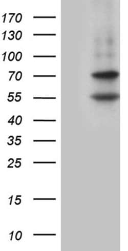 MAK Monoclonal Antibody (OTI5A11), TrueMAB , OriGene 30 &mu;L | Buy Online | Origene Technologies | Fisher Scientific